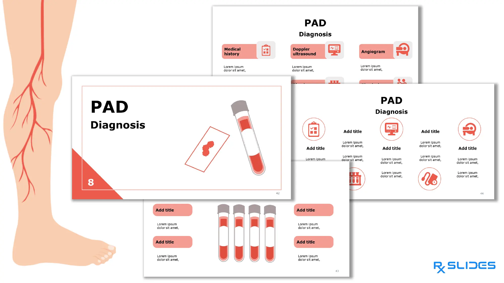Download Peripheral Arterial Disease PowerPoint Template| RxSlides