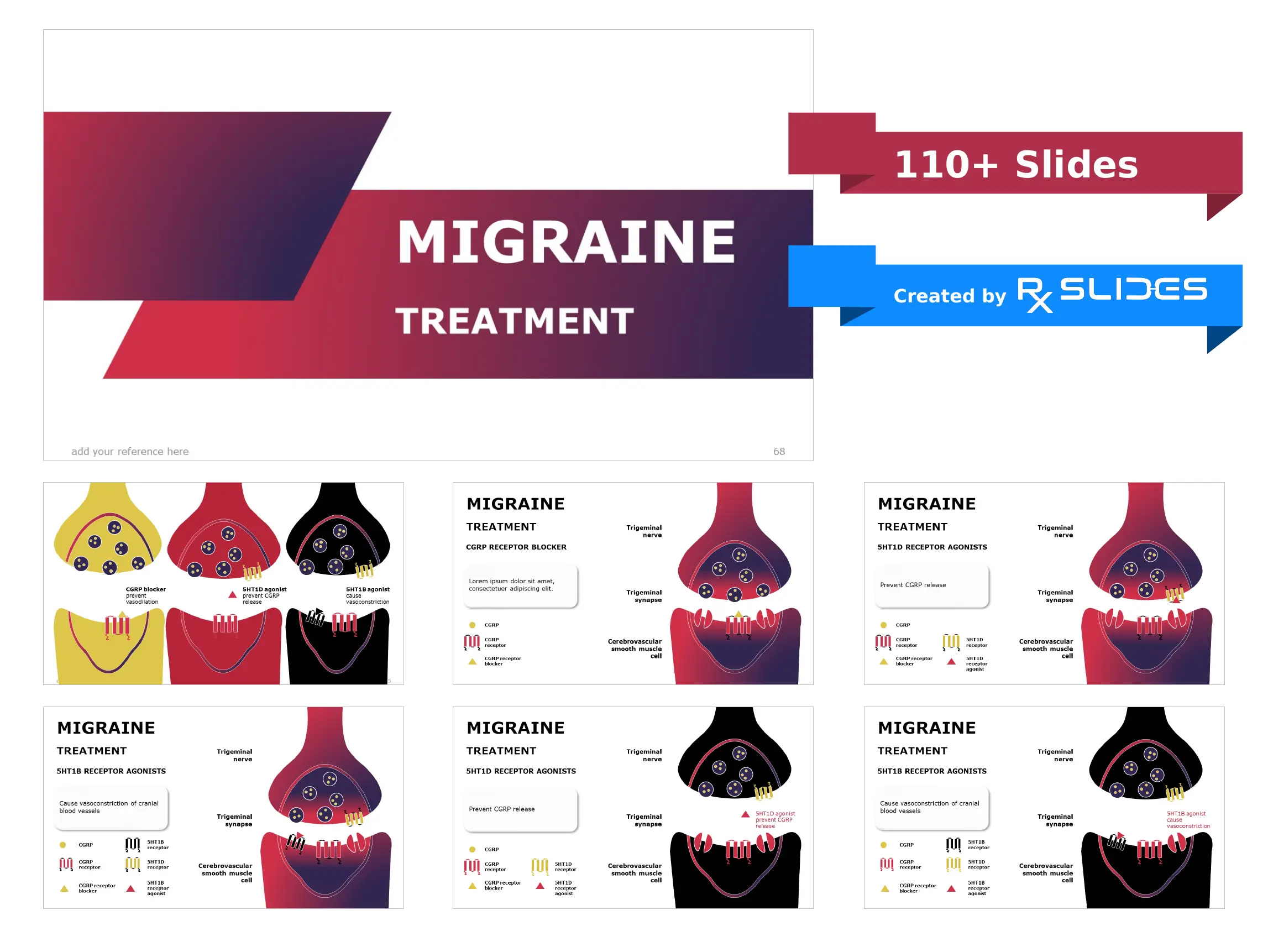 Download Migraine PowerPoint Template|RxSlides