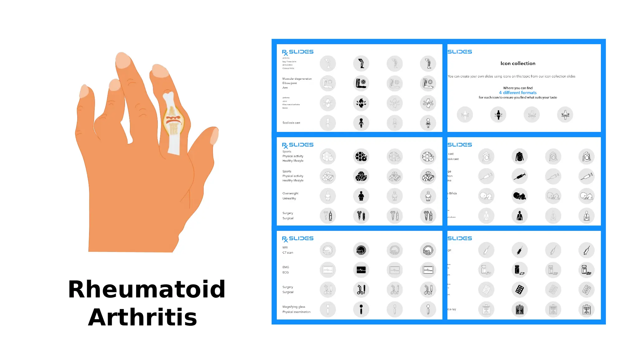 Download Rheumatoid Arthritis PowerPoint Template|RxSlides