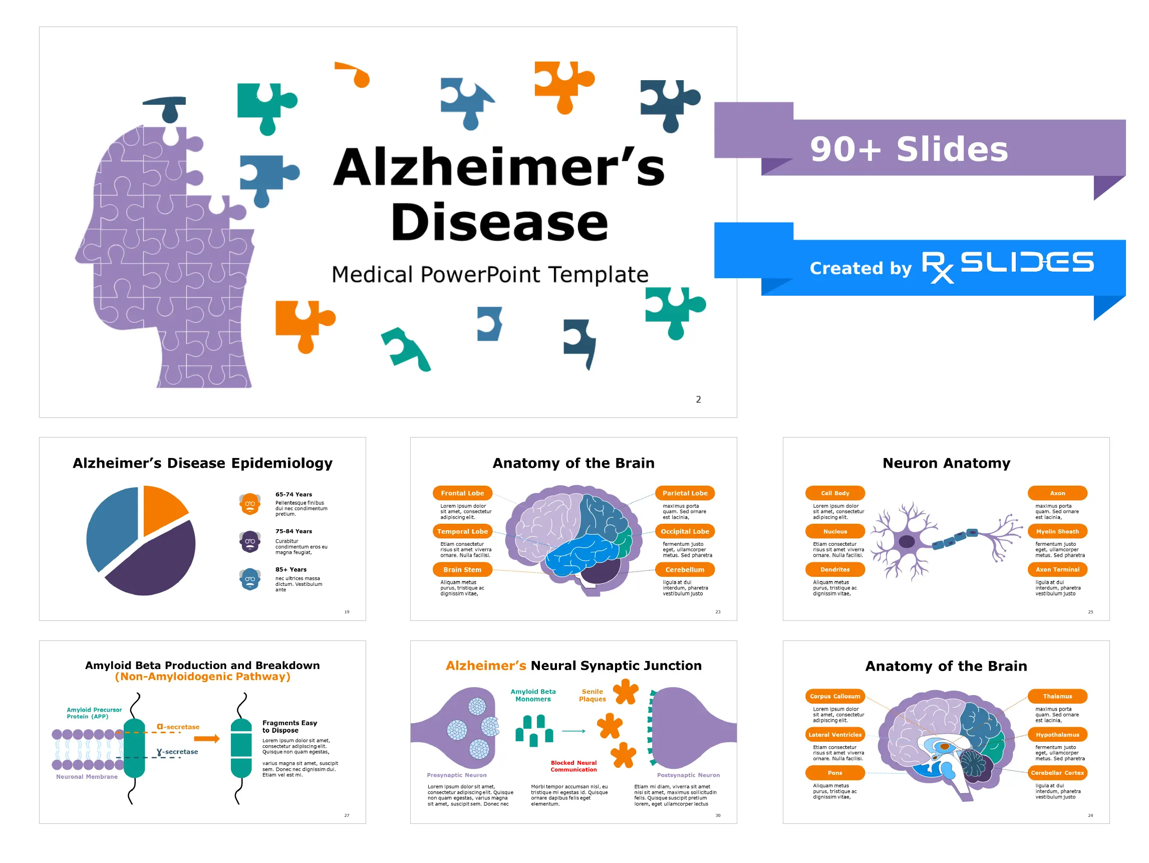 Alzheimer'S Prevention:  The Genetic Link - 69e0379
