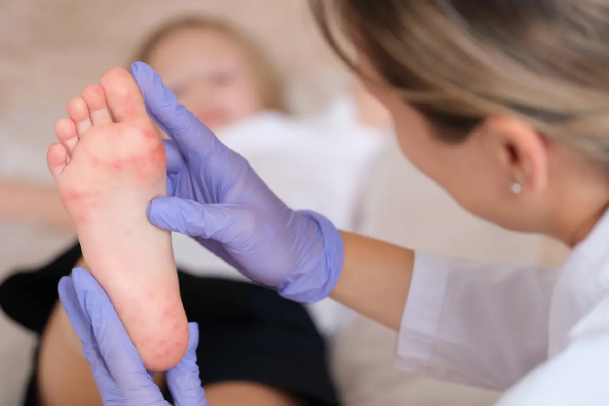 Soothing Relief for Peeling Feet Kids Causes, Symptoms, and Treatments