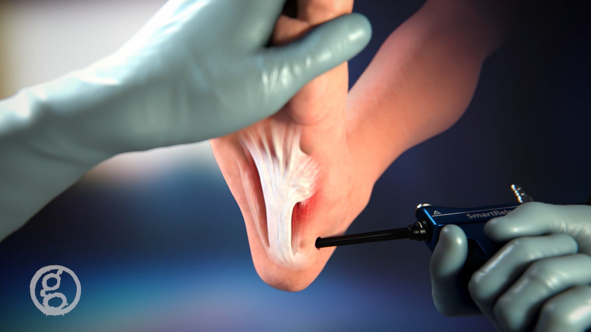 3D Medical Animation Videos Ghost Productions Inc.