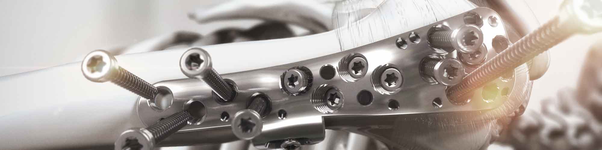 "Shoulder Arthroplasty Animation Case Study Integra Lifesciences"