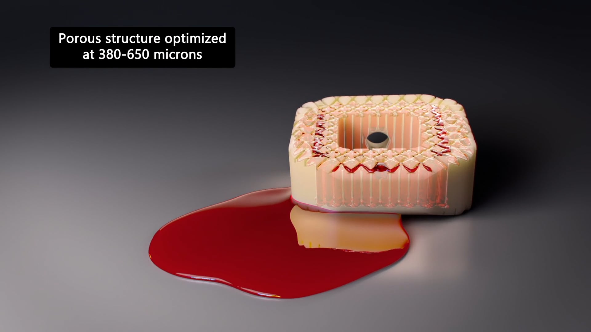 Medical Device Animation Zavation Labyrinth Peek Interbody Video