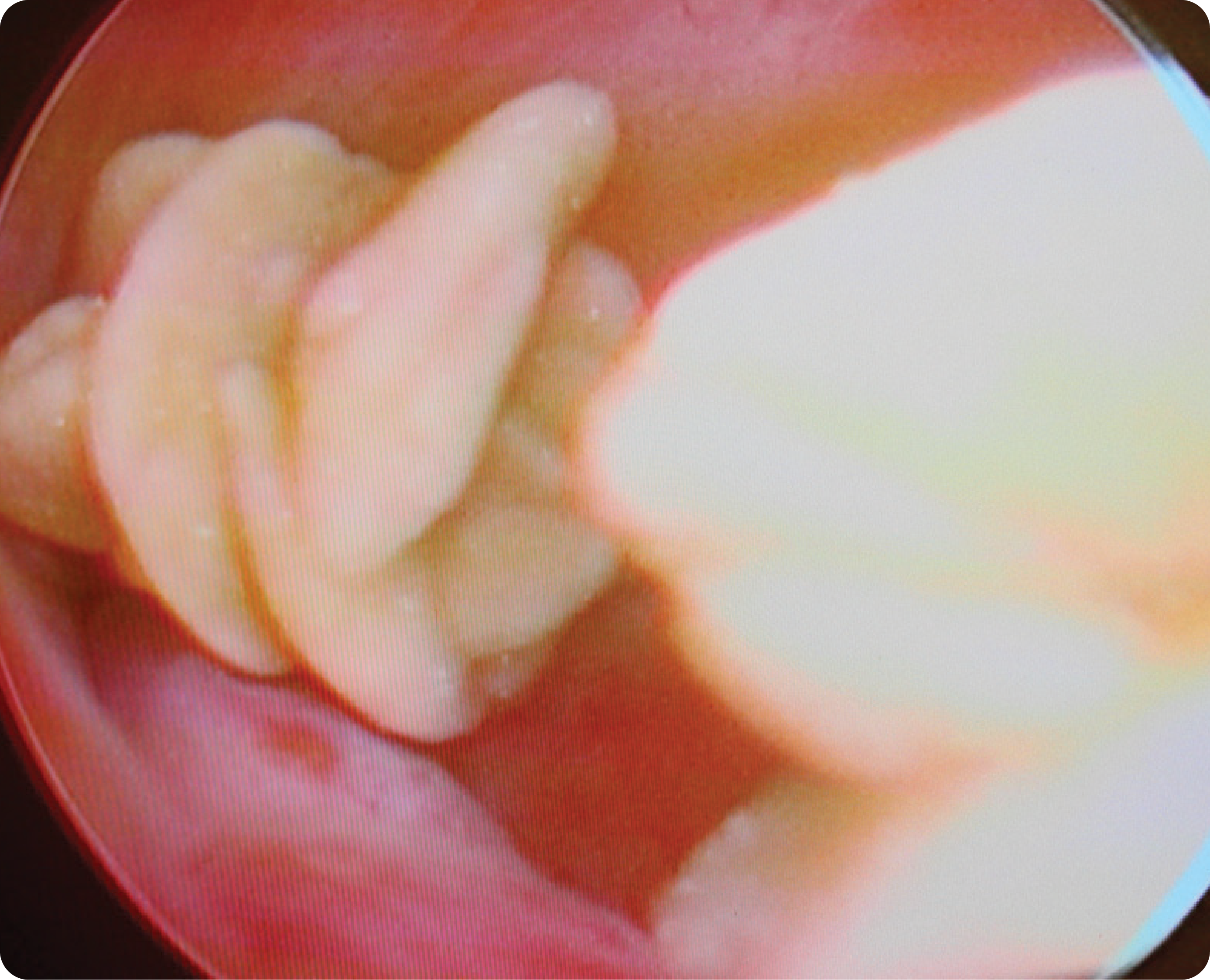 Noninvasive Laparoscopic Procedure North Oatlands Animal Hospital