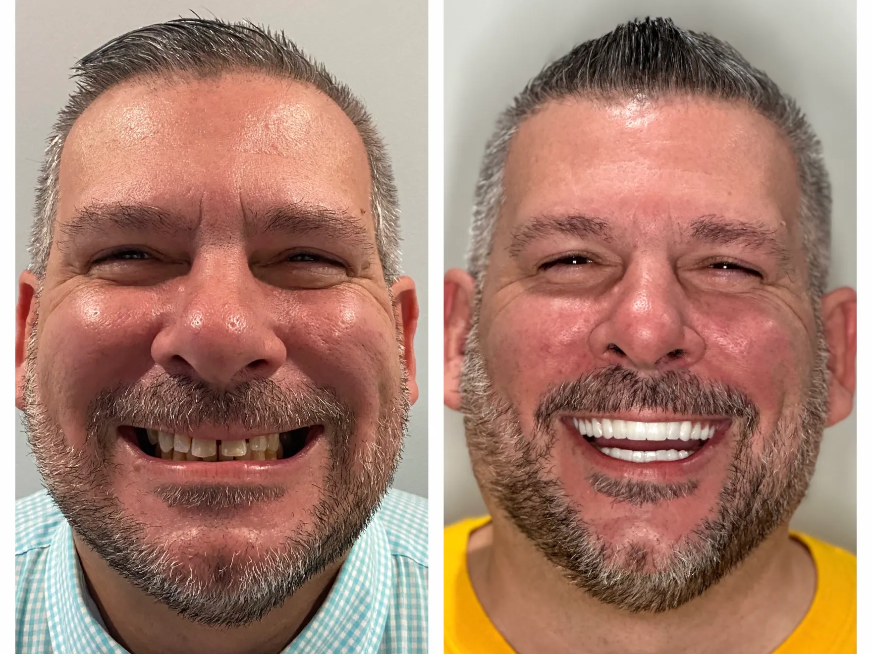 Dentist in Tampa, FL Optum Dental Arts