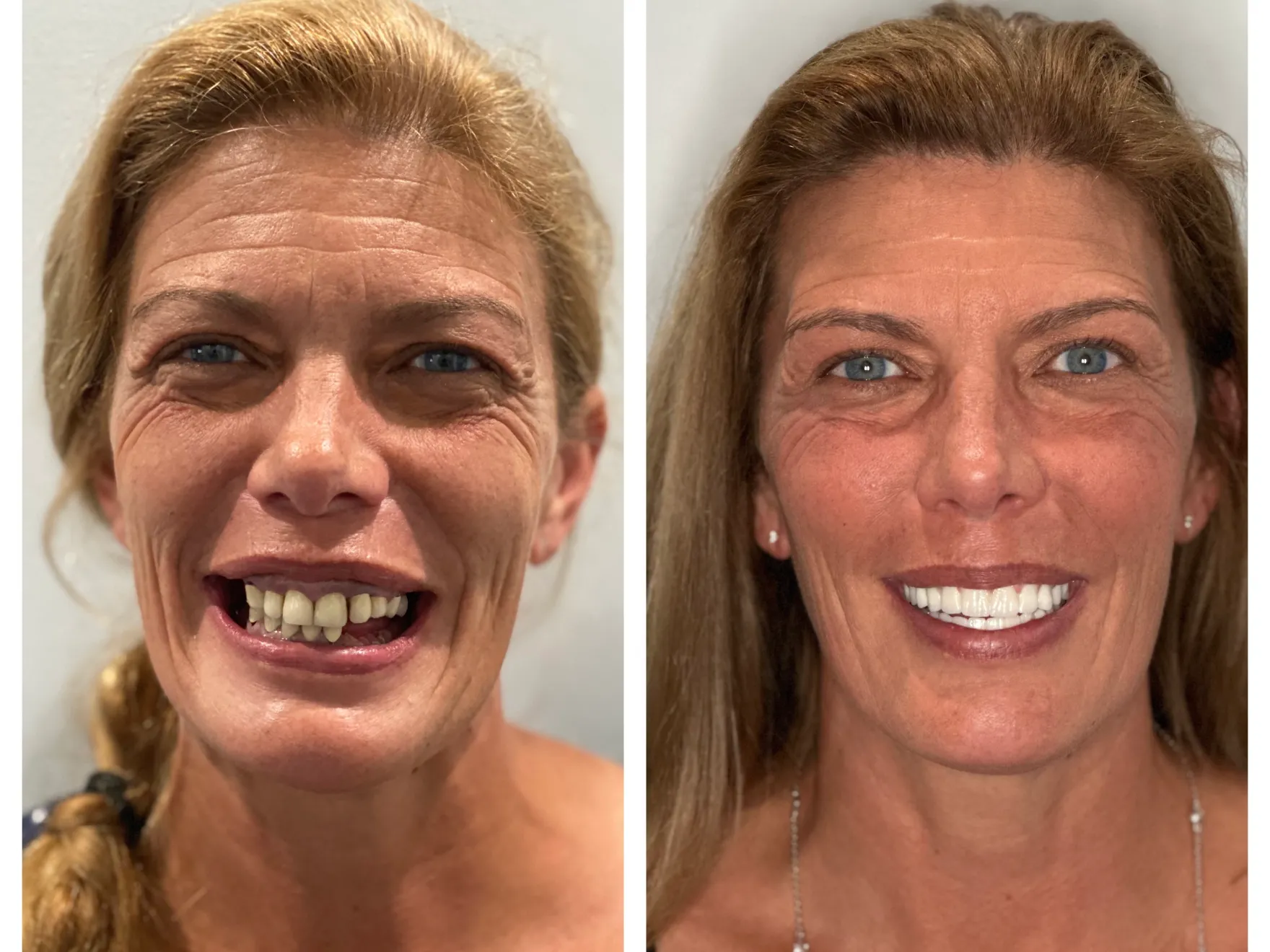 Dentist in Tampa, FL Optum Dental Arts