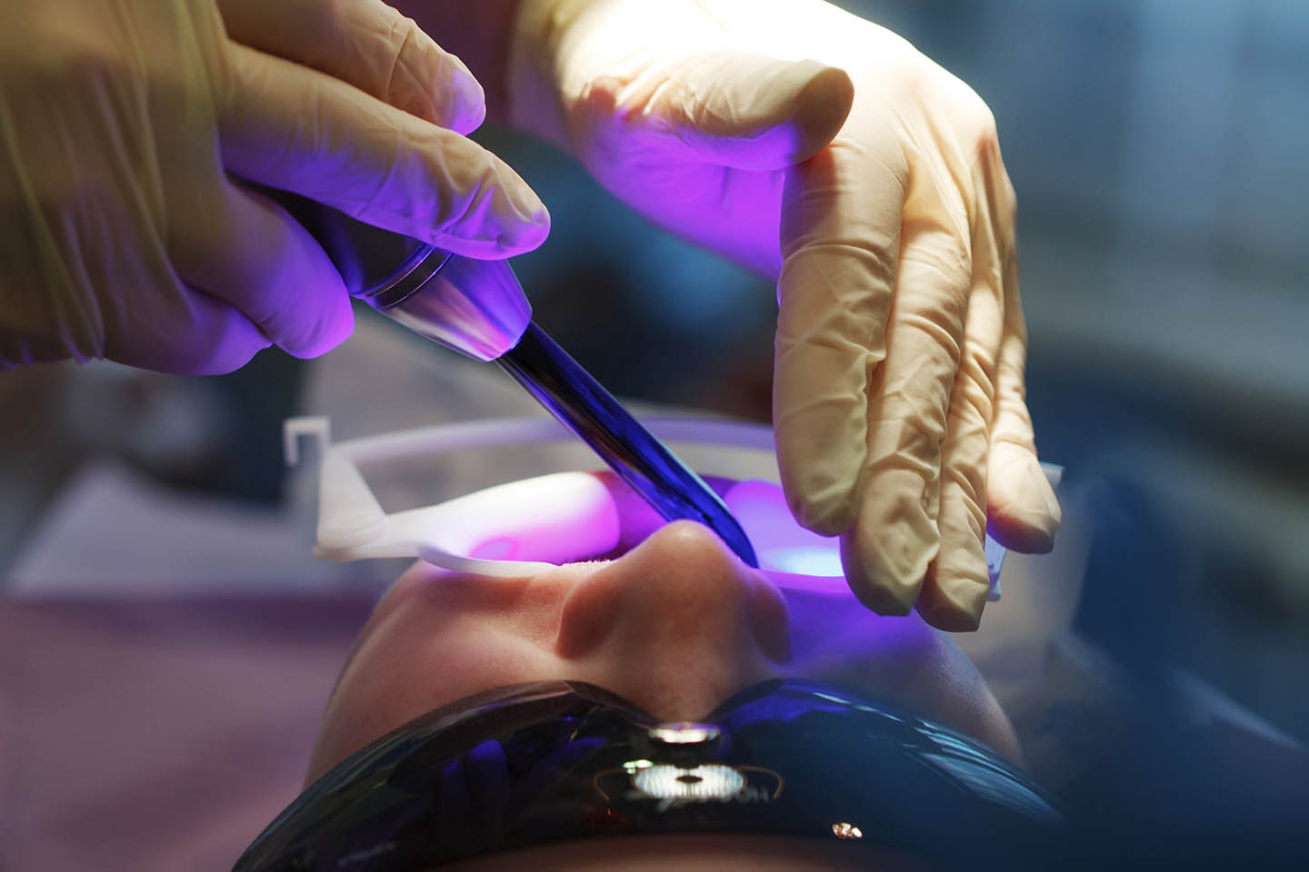 Full Mouth Rehabilitation in Carlsbad Polished General Dentistry