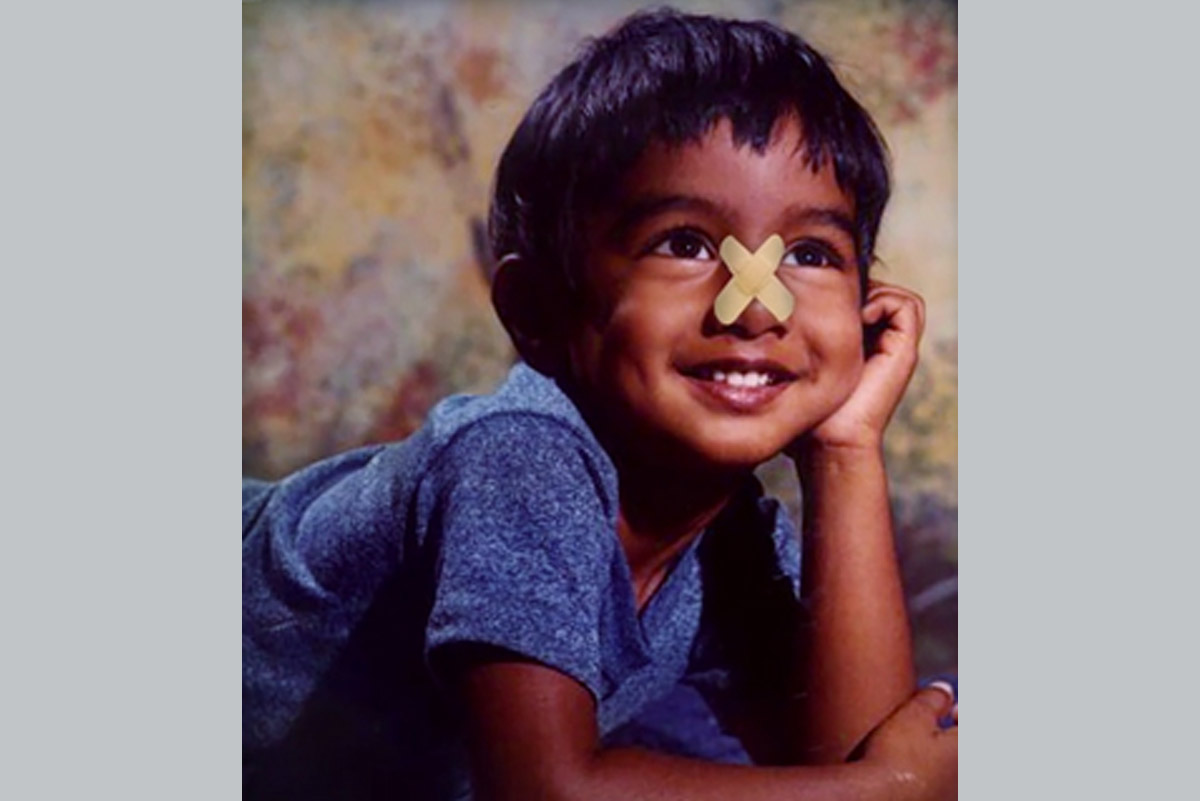 How a SevenYearOld's Broken Nose Changed the World of ENT