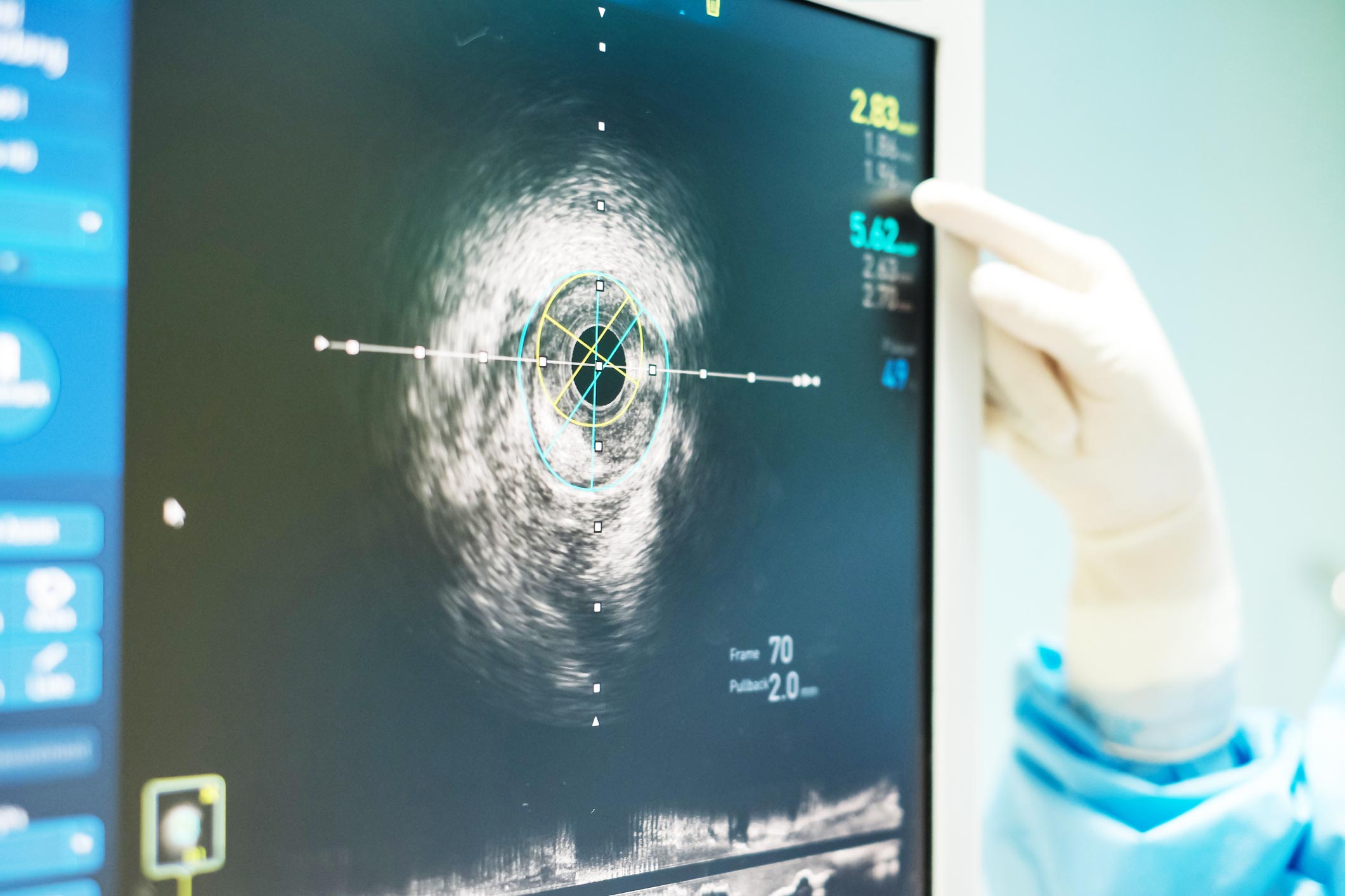 Healthscan Imaging | A Precision Medicine Company