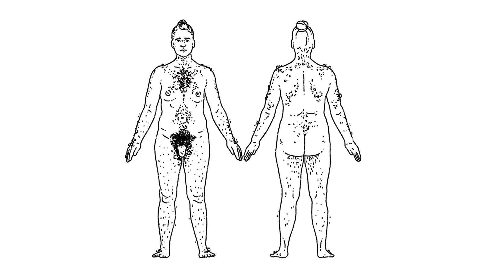 Estrogen HRT Hair Thinning and Loss explained by FOLX