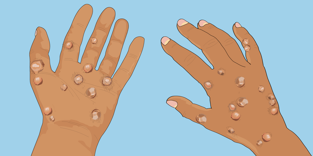 What you can do to address barriers to health care.