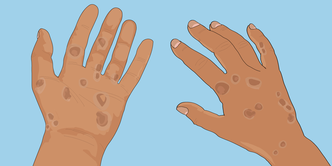 What you can do to address barriers to health care.