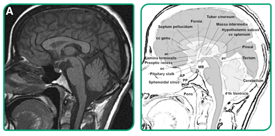 Blog Afya Educação Médica - Neuroendocrinologia: glândula hipofisária ...