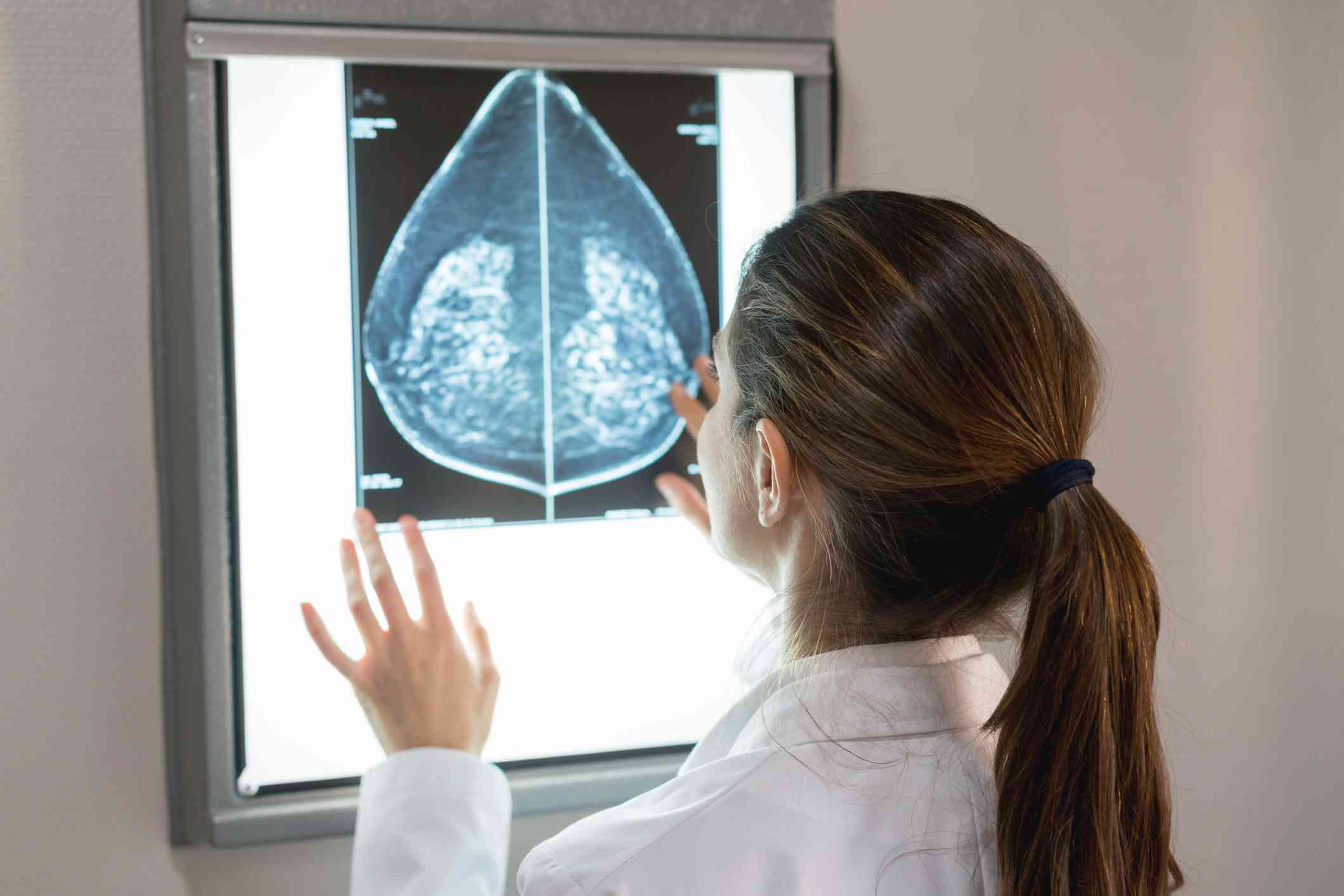 Blog Afya Educação Médica - Mastologista: o que faz um especialista em ...