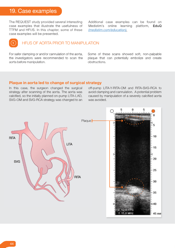 CABG Guidebook