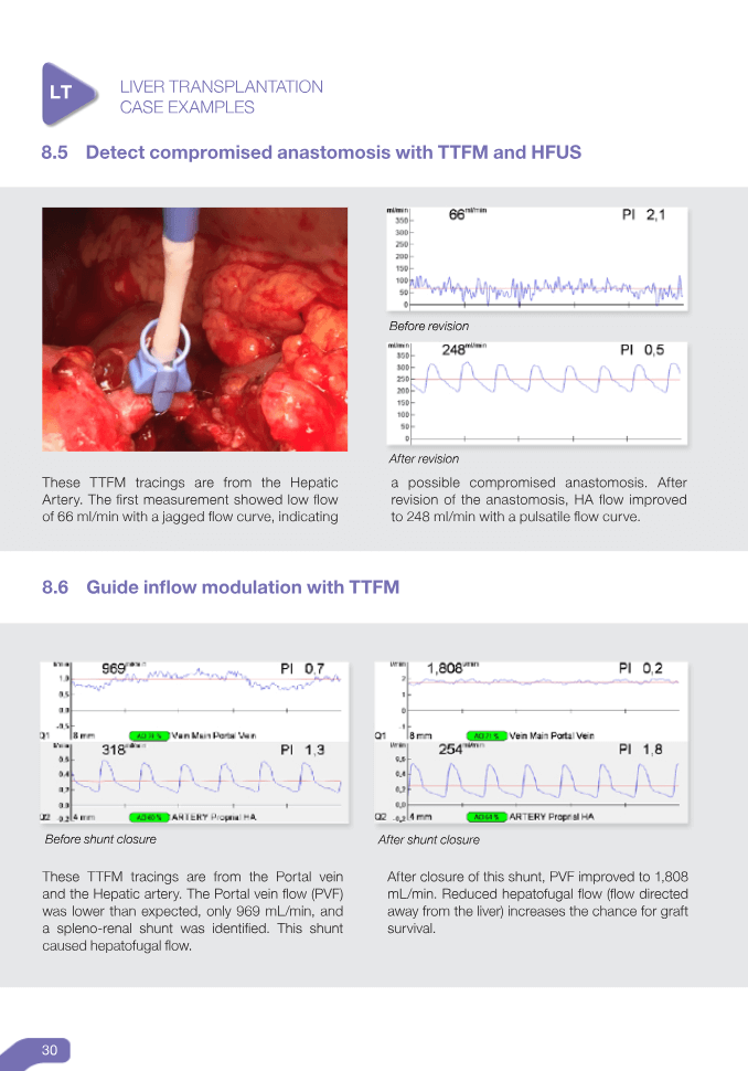 Transplant Guidebook