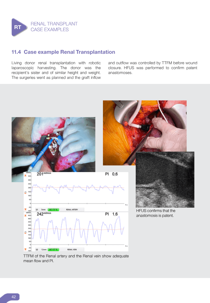 Transplant Guidebook