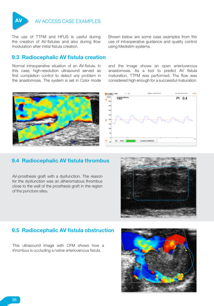 Vascular Guidebook