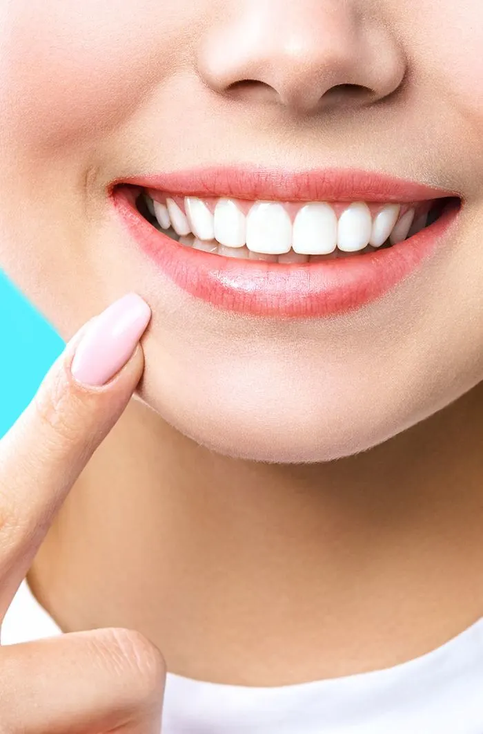 Veneers in Las Vegas Smile Oasis