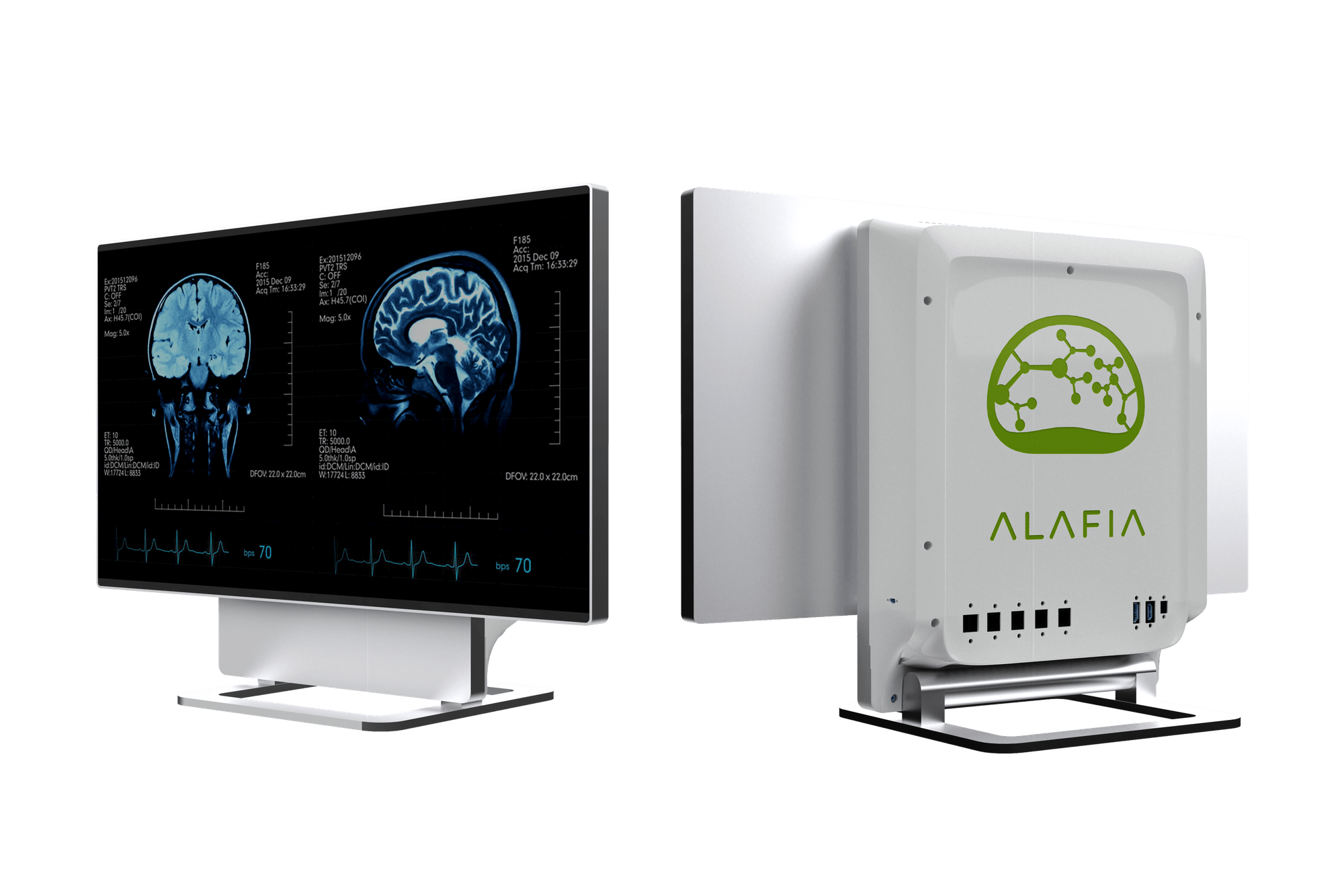 ALAFIA - Omics Computing