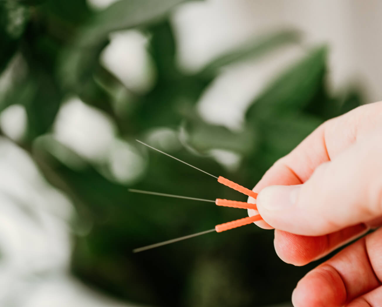 Acupuncture Treatment in San Rafael EarthSong