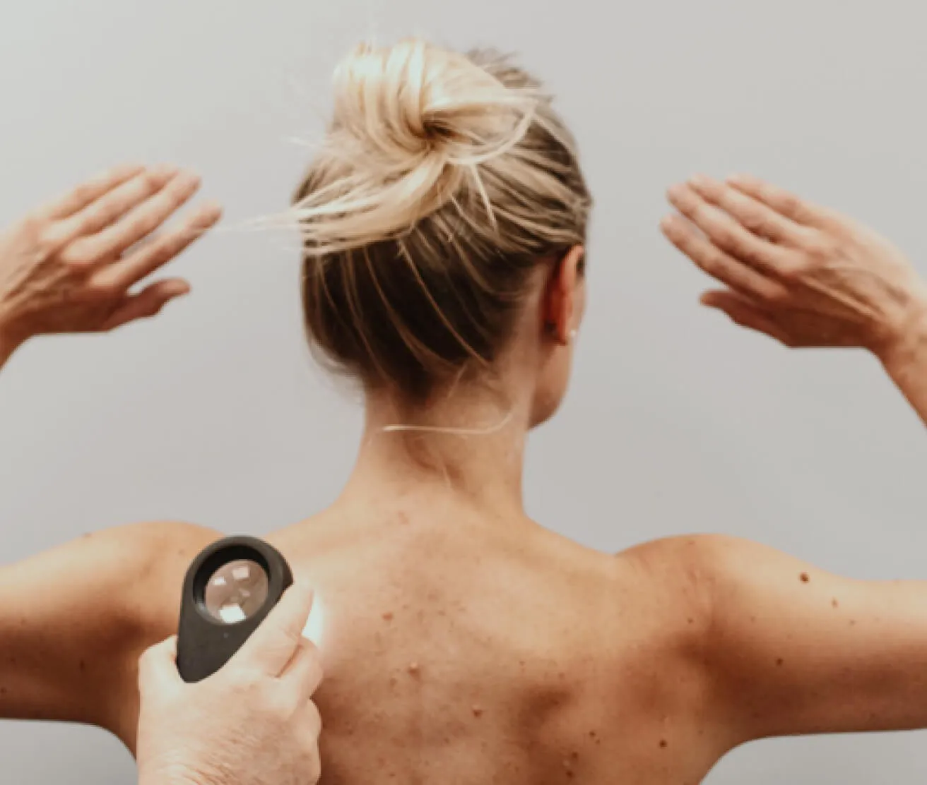 Find a MoleMap Skin Cancer Check Clinic Near You