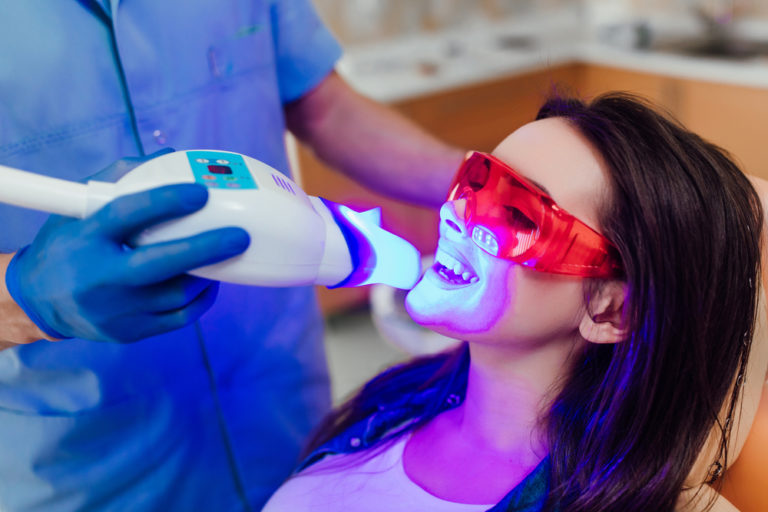 Does Teeth Whitening Damage Your Teeth? South Anchorage Dental Center