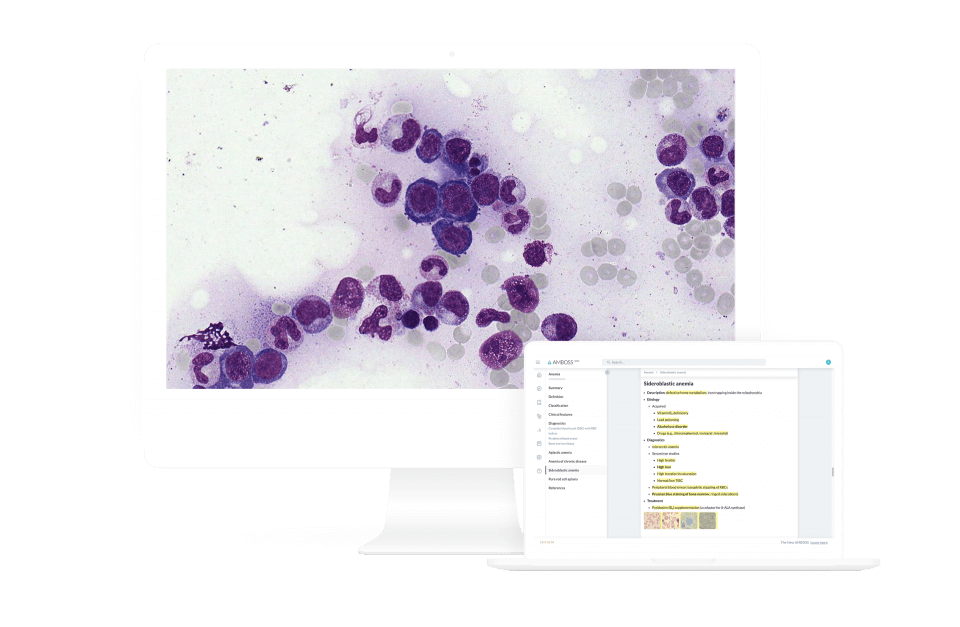 Score high on the NBME® Medicine Shelf exam with AMBOSS