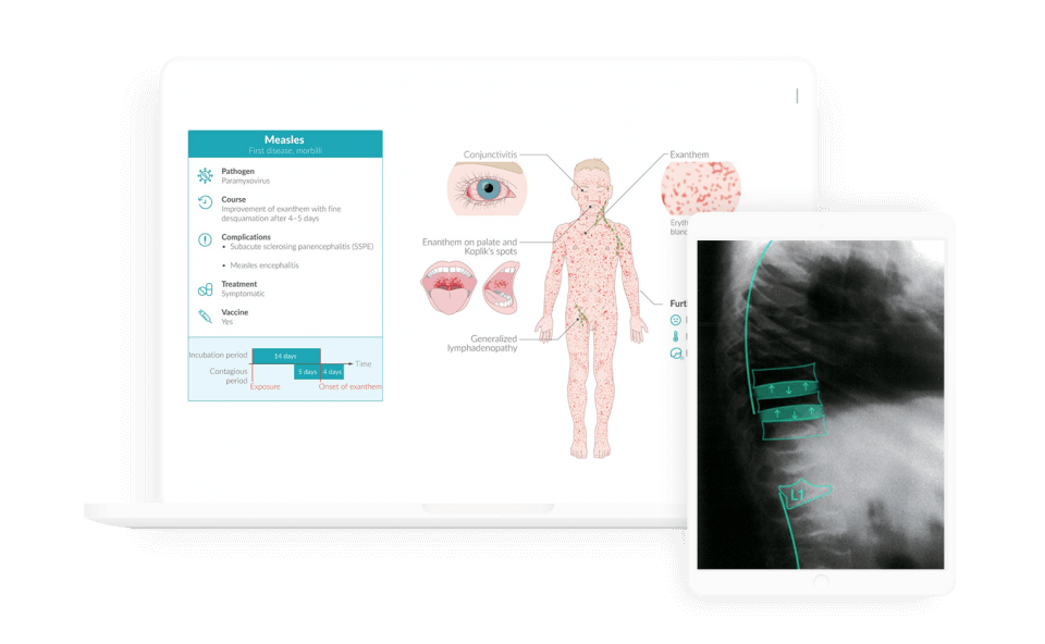 Score high on the NBME® Pediatrics Shelf exam with AMBOSS