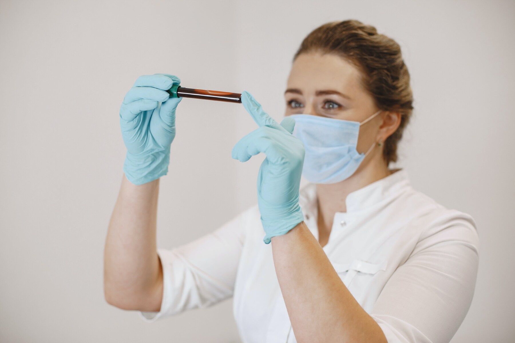 CO2 Blood Test Example Free PDF Download