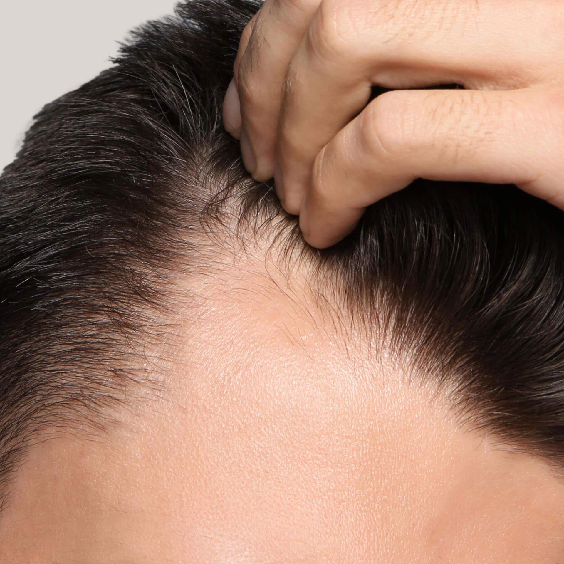 Hair Loss Renue Medical Spa