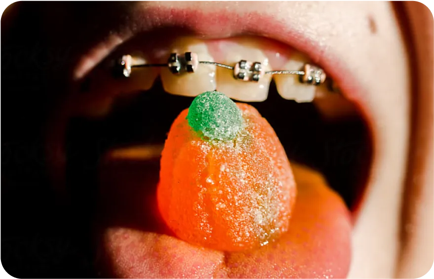 Affordable Dental Cleaning Toronto Toronto Dentists