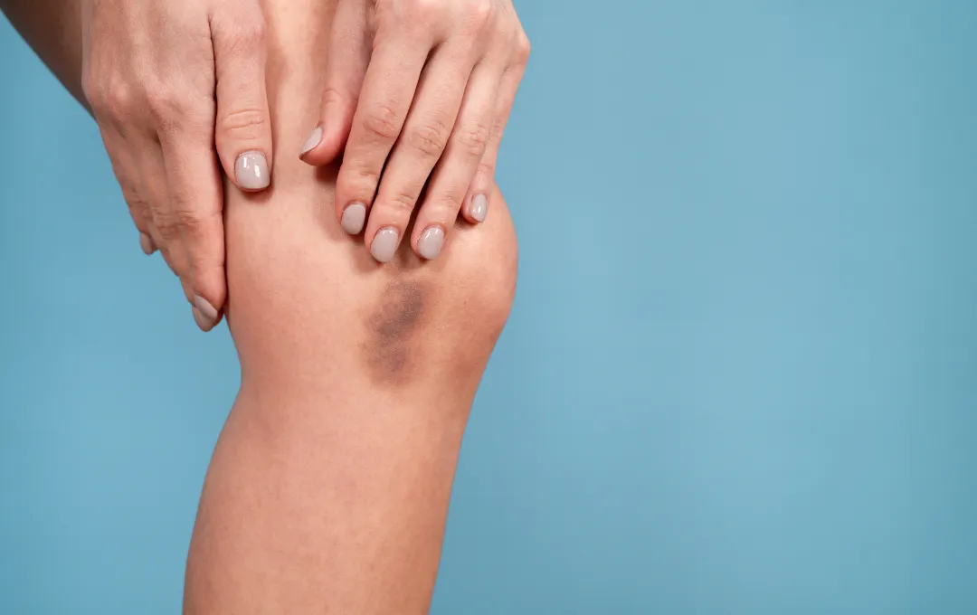 About Osgood Schlatter's Anchor Health Mississauga