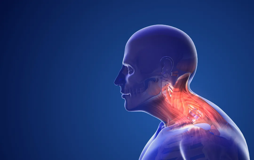 About Postural Syndromes | Anchor Health Mississauga