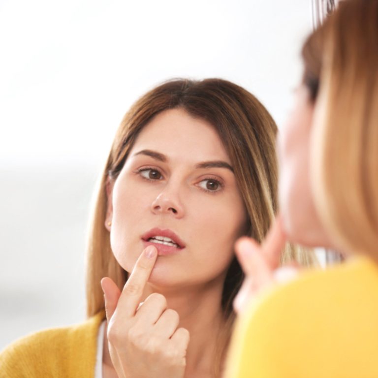 Hello Alpha Cold Sores