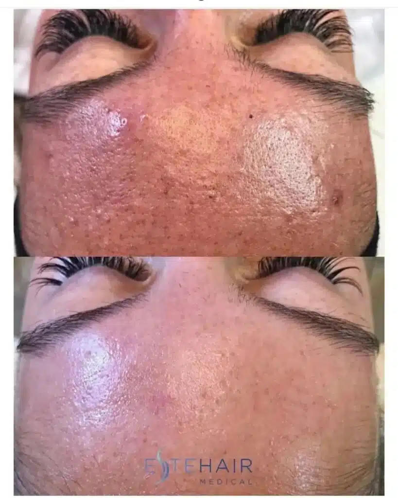 Before and After Este Hair Medical