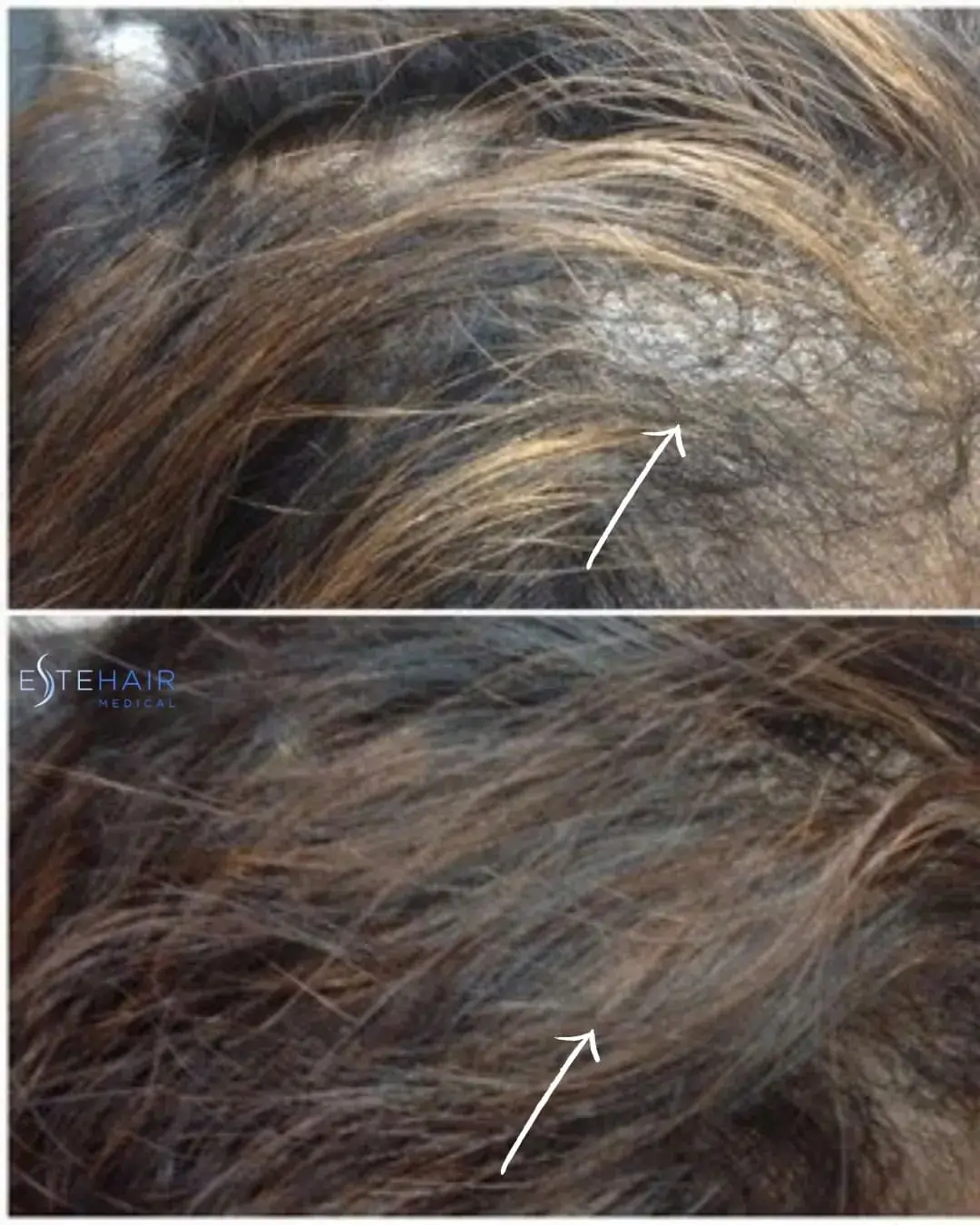 Before and After Este Hair Medical
