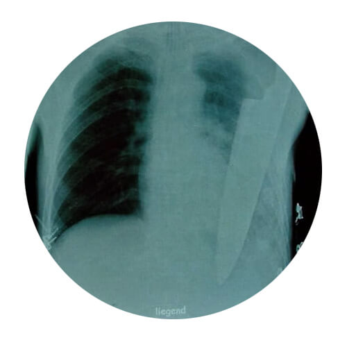 Score high on the NBME® Surgery Shelf exam with AMBOSS