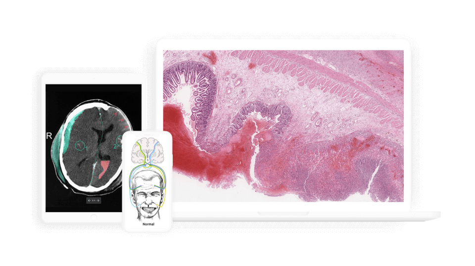 Score high on the NBME® Surgery Shelf exam with AMBOSS