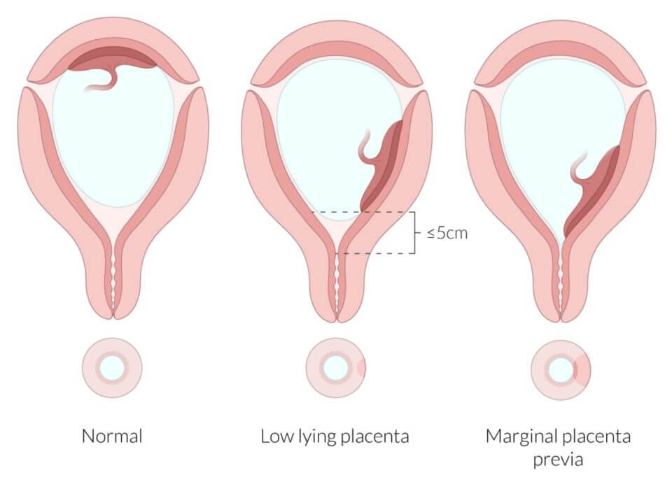 Score high on the NBME® OBGYN