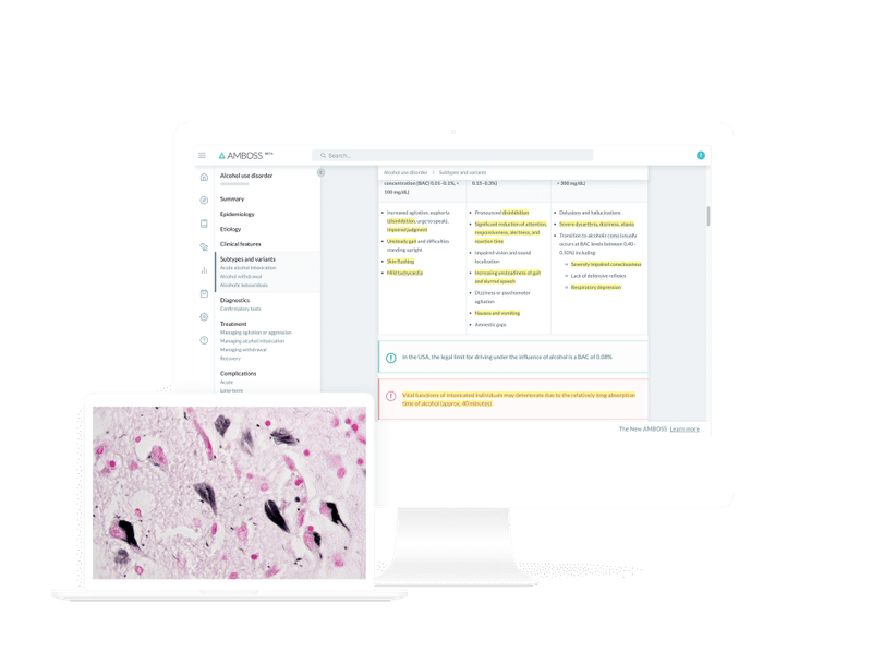 Score high on the NBME® Psychiatry Shelf exam with AMBOSS