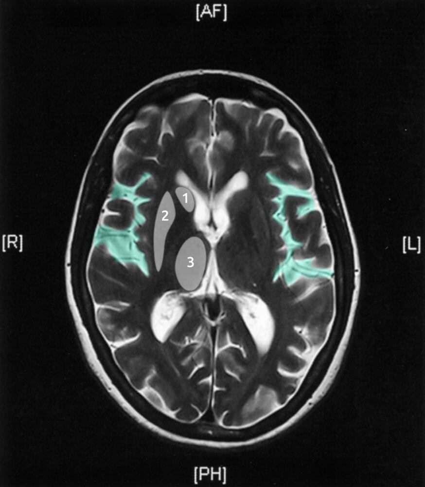 Score high on the NBME® Psychiatry Shelf exam with AMBOSS