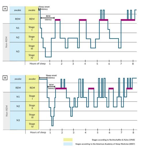 Score high on the NBME® Psychiatry Shelf exam with AMBOSS