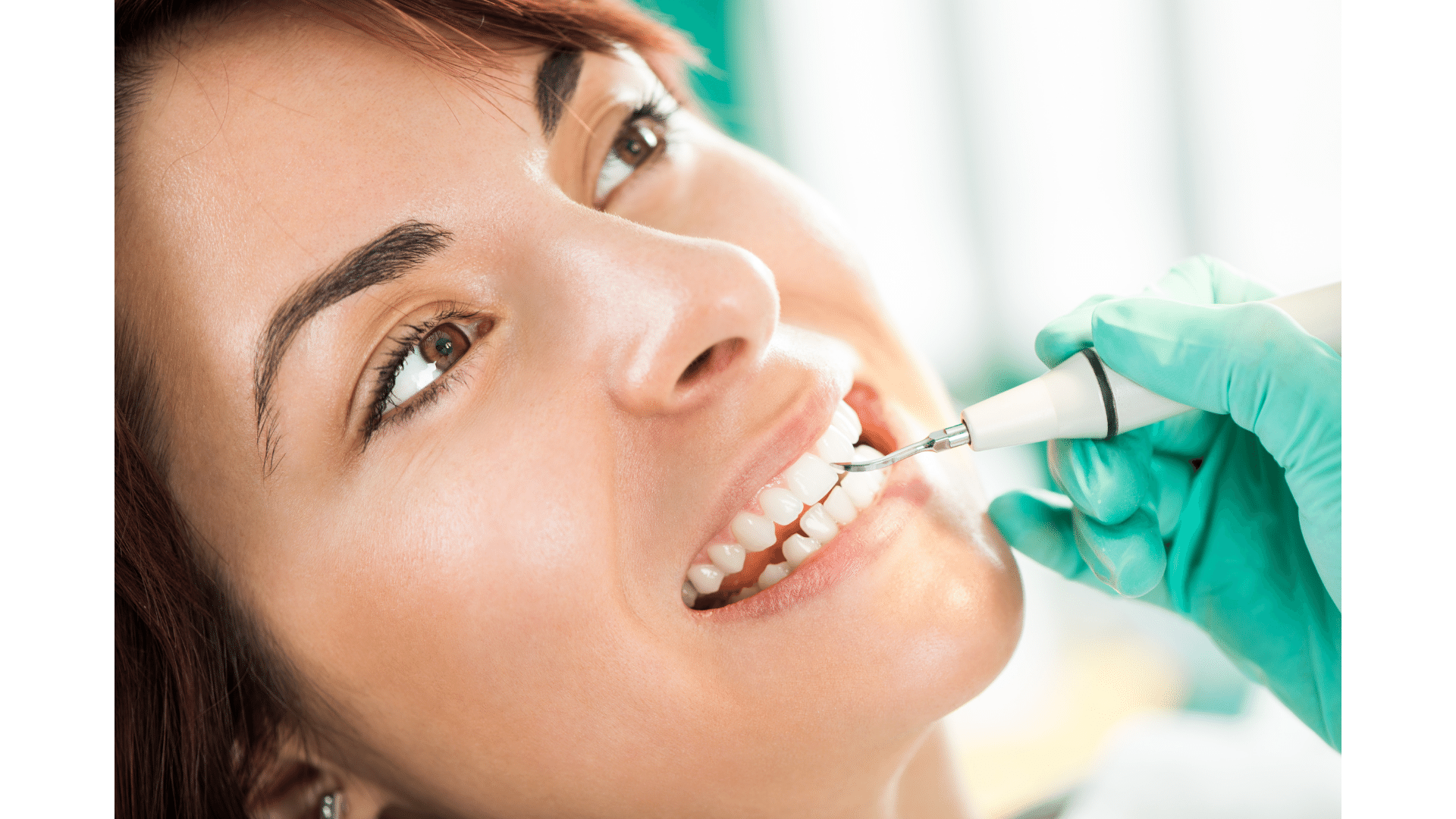 Demystifying Teeth Cleaning Your Path to Dental Wellness in Hyderabad
