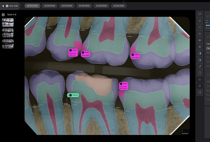 a computer screen with a picture of a tooth