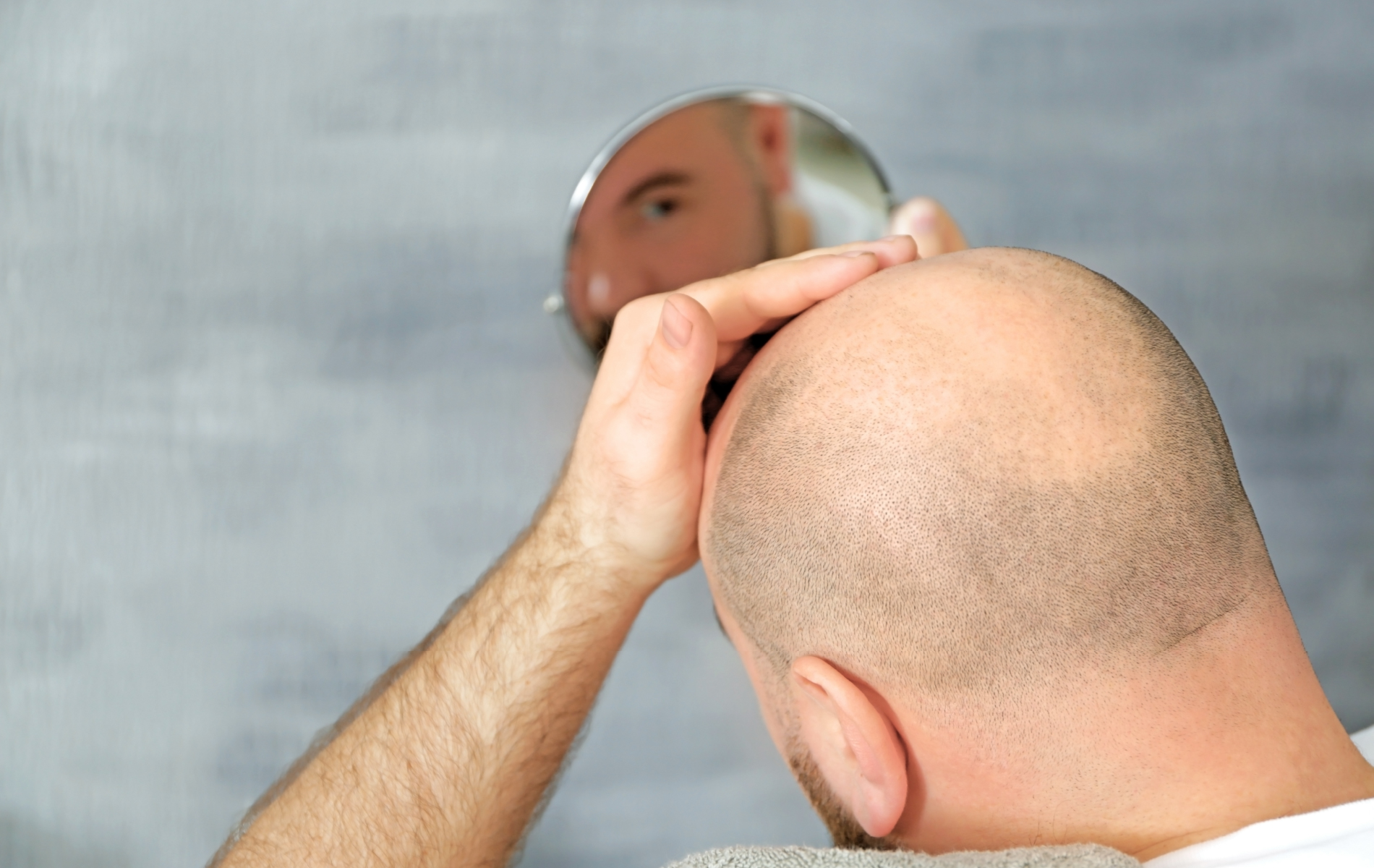 What Is Minoxidil and How Does It Work?
