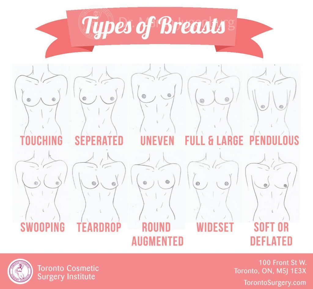 the-10-types-of-breasts-shapes-and-types-sixsurgery
