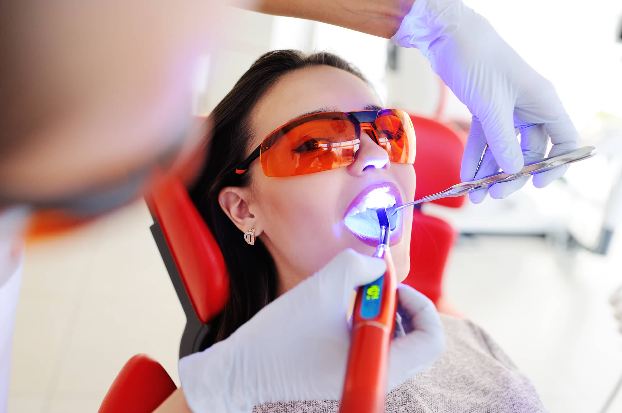 Why Are Composite Resin Fillings Better Than Amalgam Fillings? Houston, TX