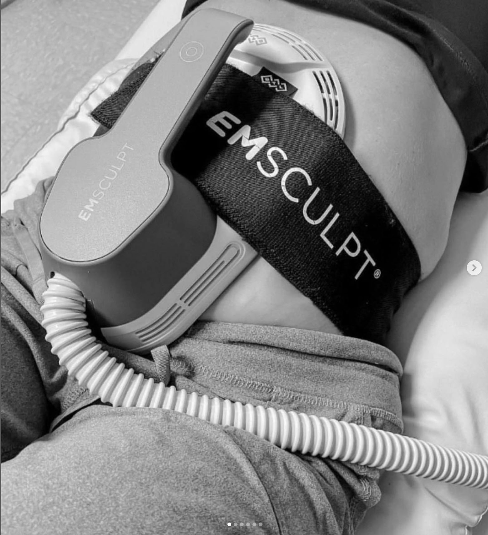 EMSculpt